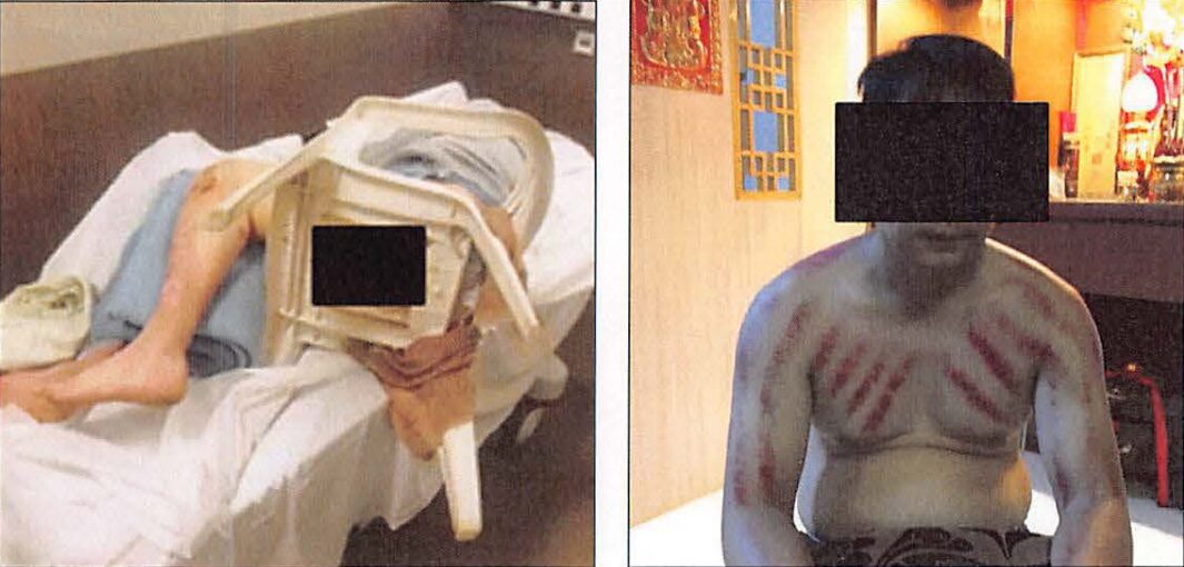 Nhiều thanh niên bị tra tấn dã man khi nghe lời dụ dỗ qua Campuchia làm việc